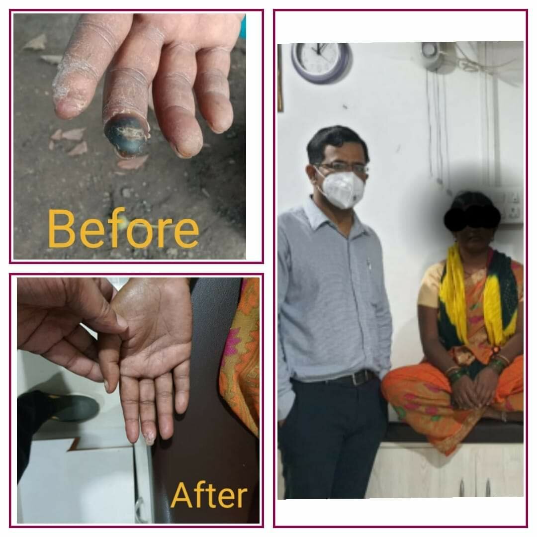 Case study of a Patient - Dr. Yogesh Jamage|Jamage Heart Centre|Shivaji Road,Miraj