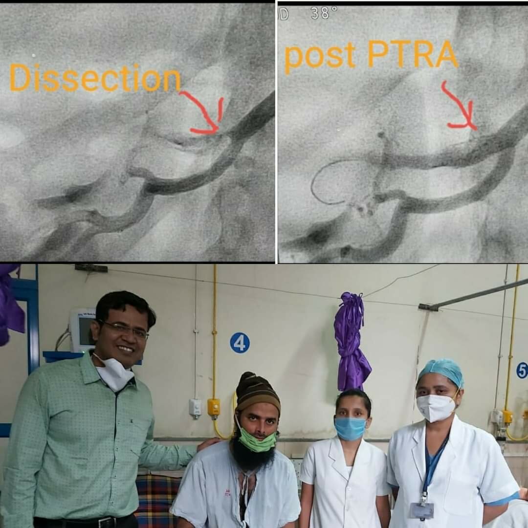 Rare case with rare presentation in COVID-19 pandemic|Jamage Heart Centre|Shivaji Road,Miraj