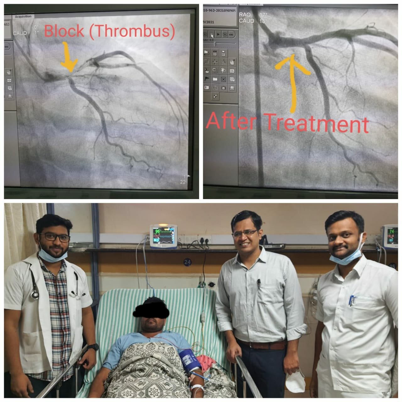 Sometimes Angioplasty is not a solution because Every Life Matters|Jamage Heart Centre|Shivaji Road,Miraj