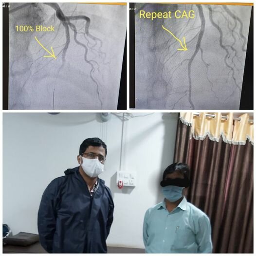 Subsequent Heart Attack after COVID - Dr. Yogesh Jamage|Jamage Heart Centre|Shivaji Road,Miraj